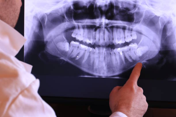 Best Emergency Dentist for Lost Fillings or Crowns in Fairlea, WV