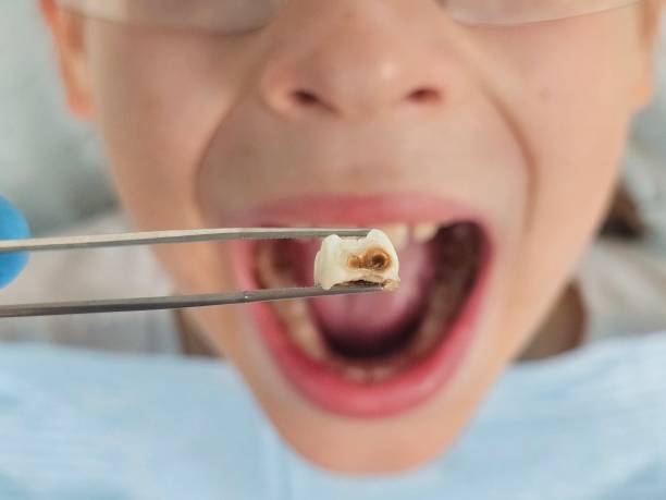 Best Emergency Dental Services for Seniors in Fairlea, WV