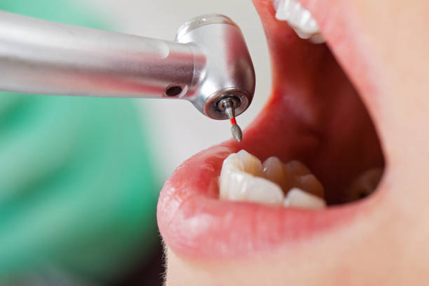 Best Mobile Emergency Dentist in Fairlea, WV